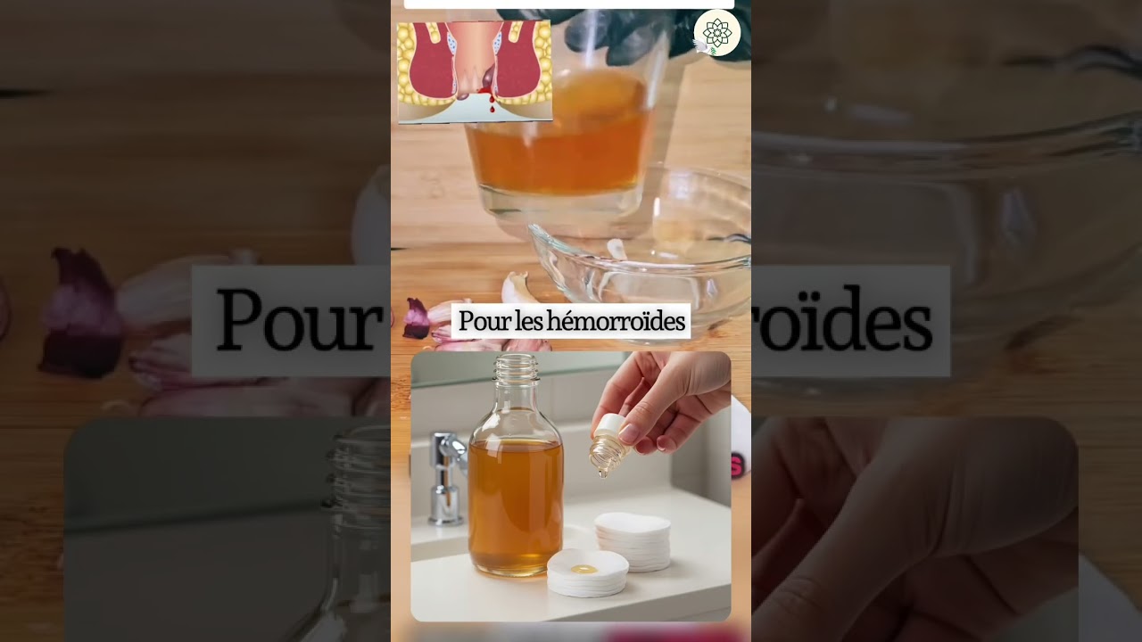 Adieu les h&eacute;morro&iuml;des : la m&eacute;thode naturelle et efficace #h&eacute;morro&iuml;des #vinaigredecidre #rem&egrave;de