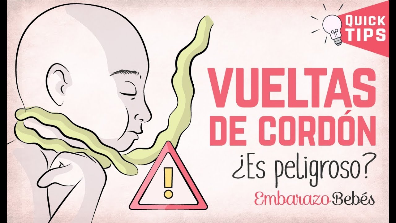 MI BEBÉ tiene VUELTAS DE #CORDÓN 👶🏼👩🏼‍⚕️ ¿Es peligroso para el parto?