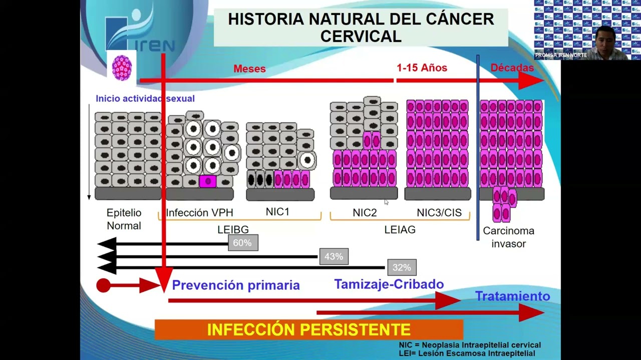 📌 TELEIEC  PREVENCIÓN DEL CÁNCER DE CUELLO UTERINO - ACTUALIZACIÓN EN LA VACUNA VPH