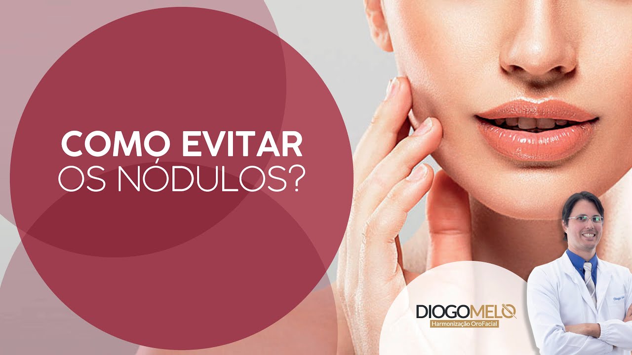 Como Evitar Nódulos no Sulco Nasolabial