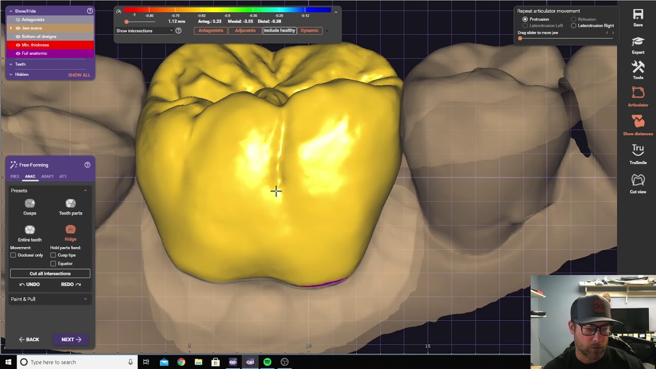 How to: Upper and Lower Molar Design
