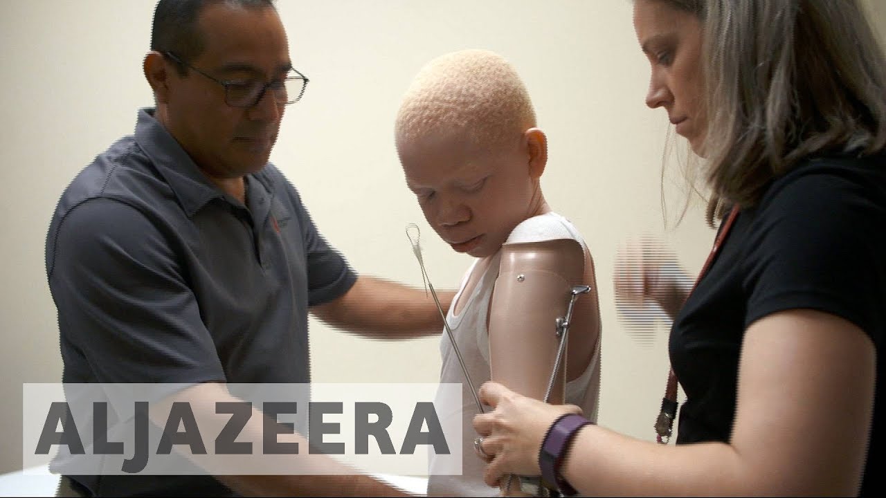 Tanzanian albino victims receive treatment in the US