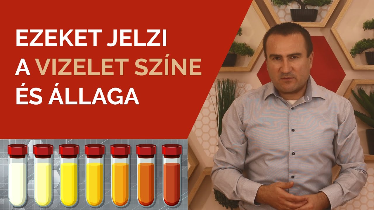 Ezeket jelzi a Vizelet sz&iacute;ne &eacute;s &aacute;llaga