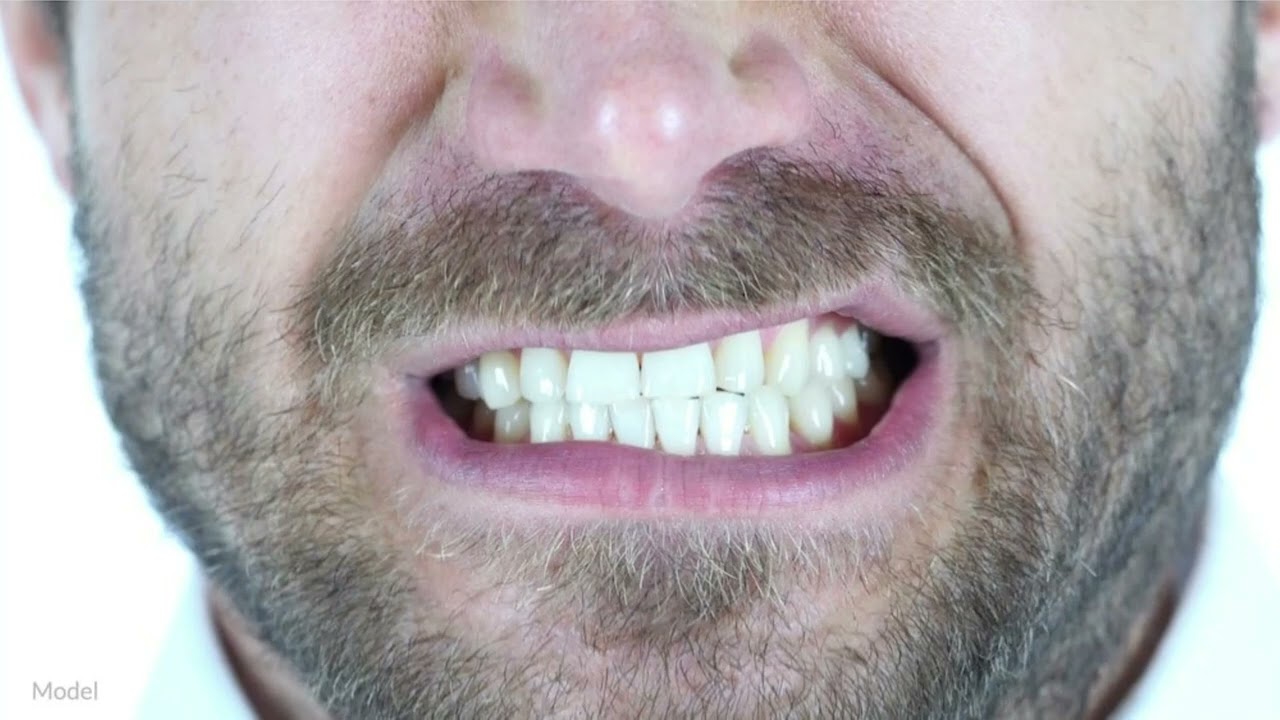 Rechinar, chasquear y casta&ntilde;etear los dientes 🦷​ // Humano Efecto de sonido