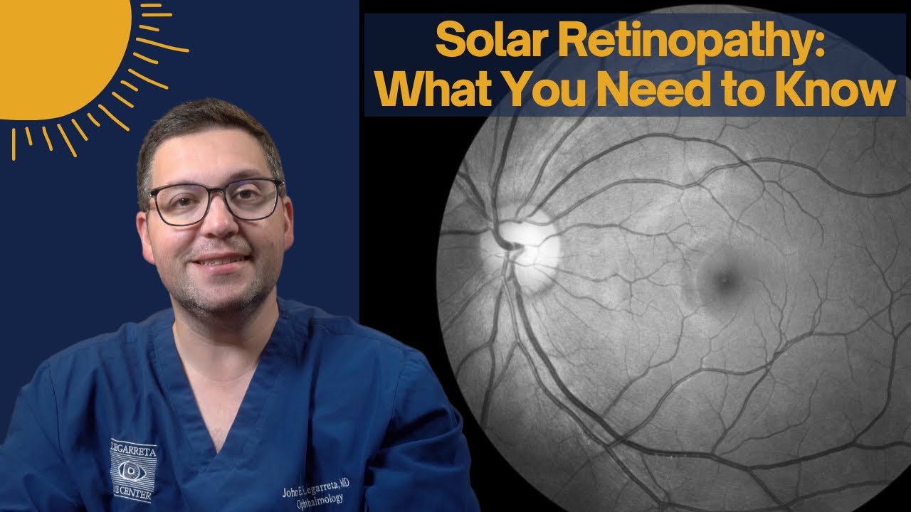 What is Solar Retinopathy? Explained by MD