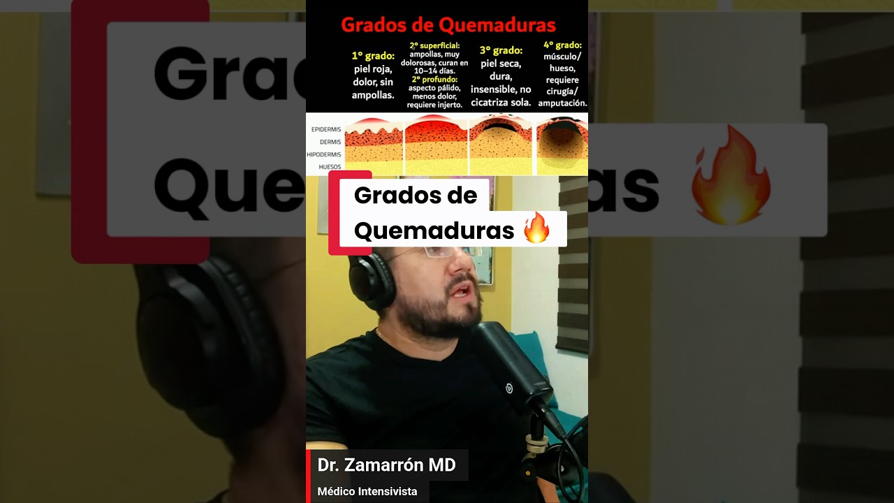 🔥 Grados de Quemaduras: Implicaciones en diagn&oacute;stico y manejo #emergencias