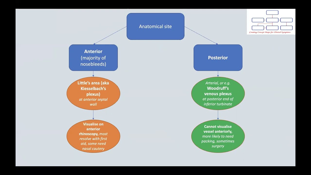 Concept maps: Approach to A patient with Epistaxis
