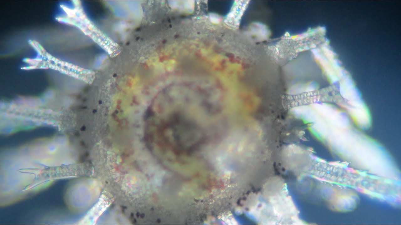 ウニの発生 （受精~プルテウス幼生～ウ二まで）　高校生物実験