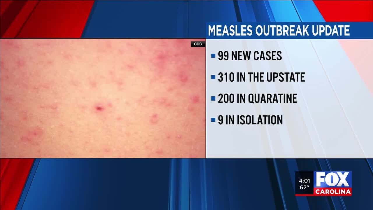 Spike in Upstate measles outbreak, nearly 100 new cases, hundreds more &lsquo;likely&rsquo;
