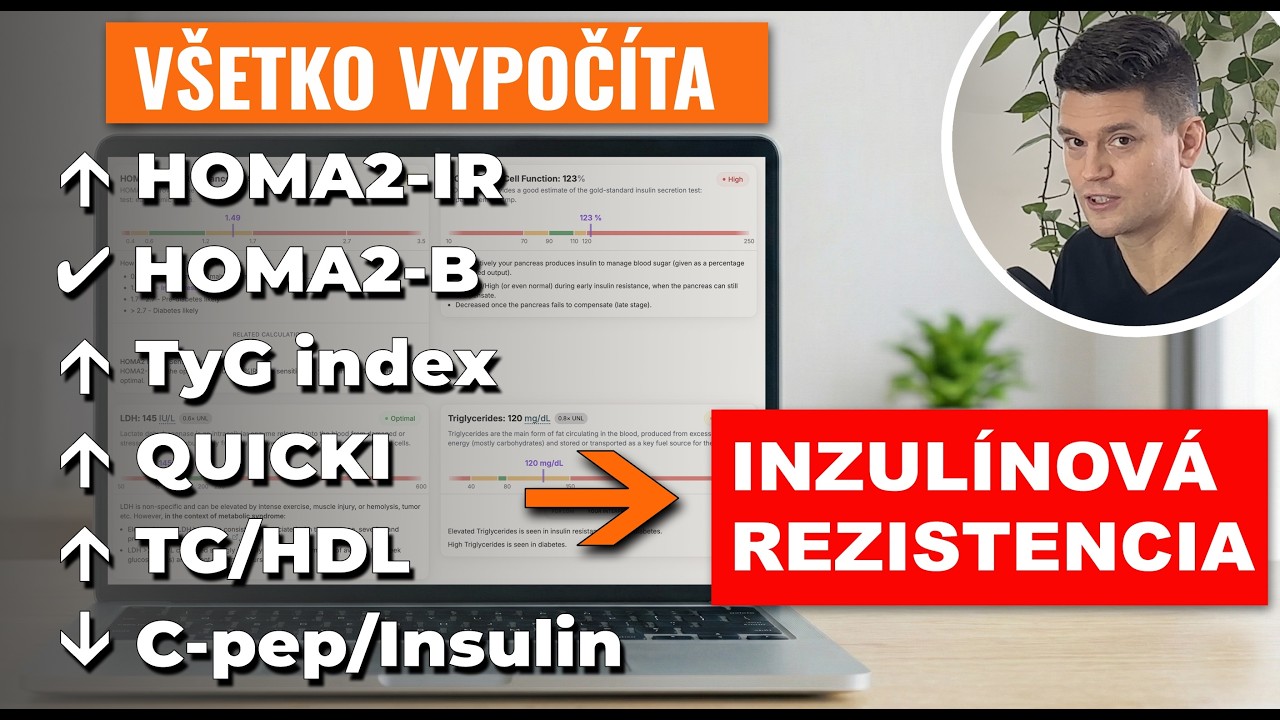 Nástroj na interpretáciu metabolizmu glukózy - precízna diagnostika