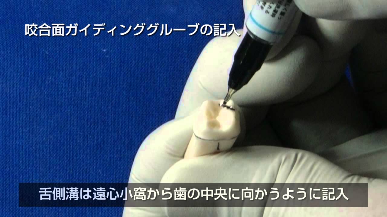 西川義昌先生・支台歯形成臼歯編