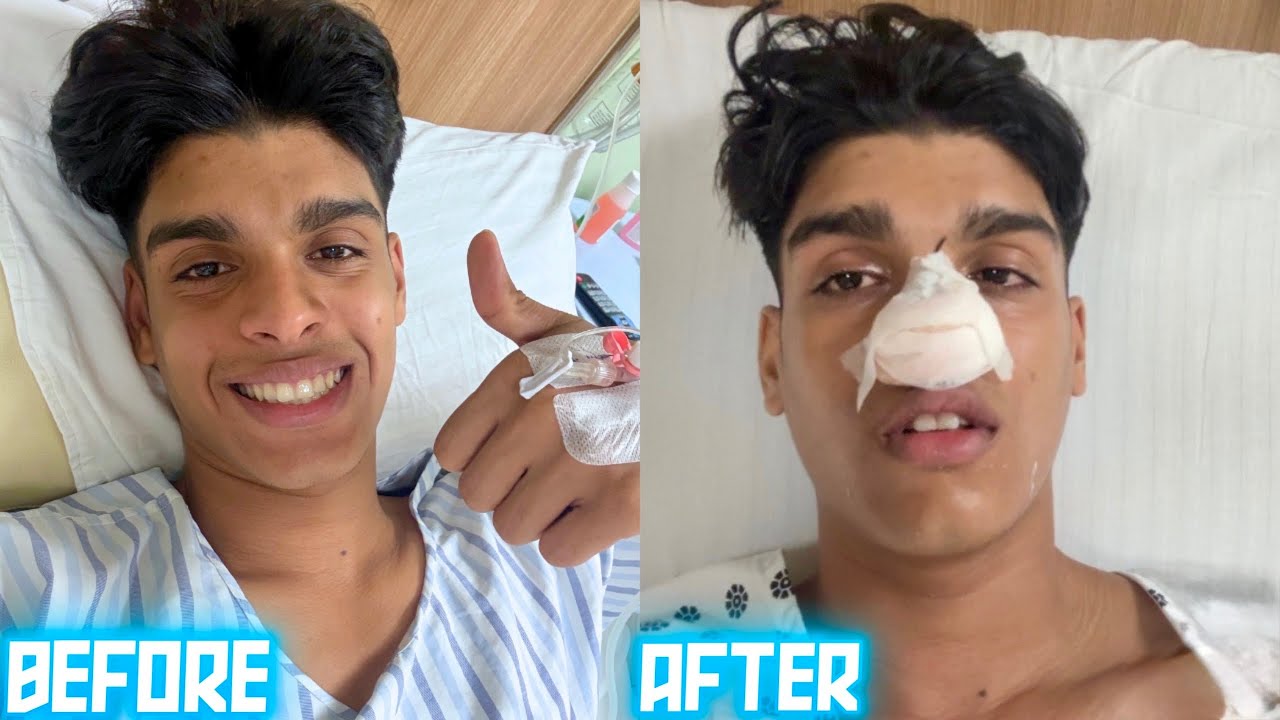 BEFORE SURGERY VS AFTER SURGERY🥲