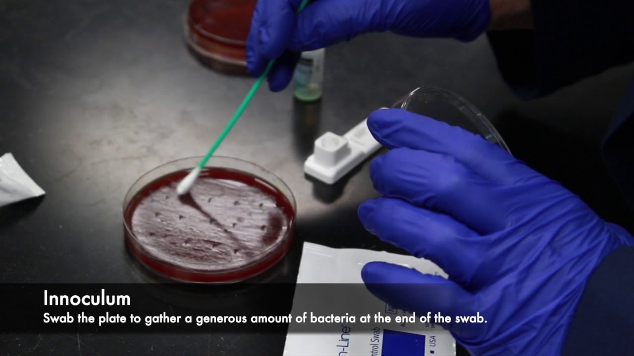 Rapid Strep Test