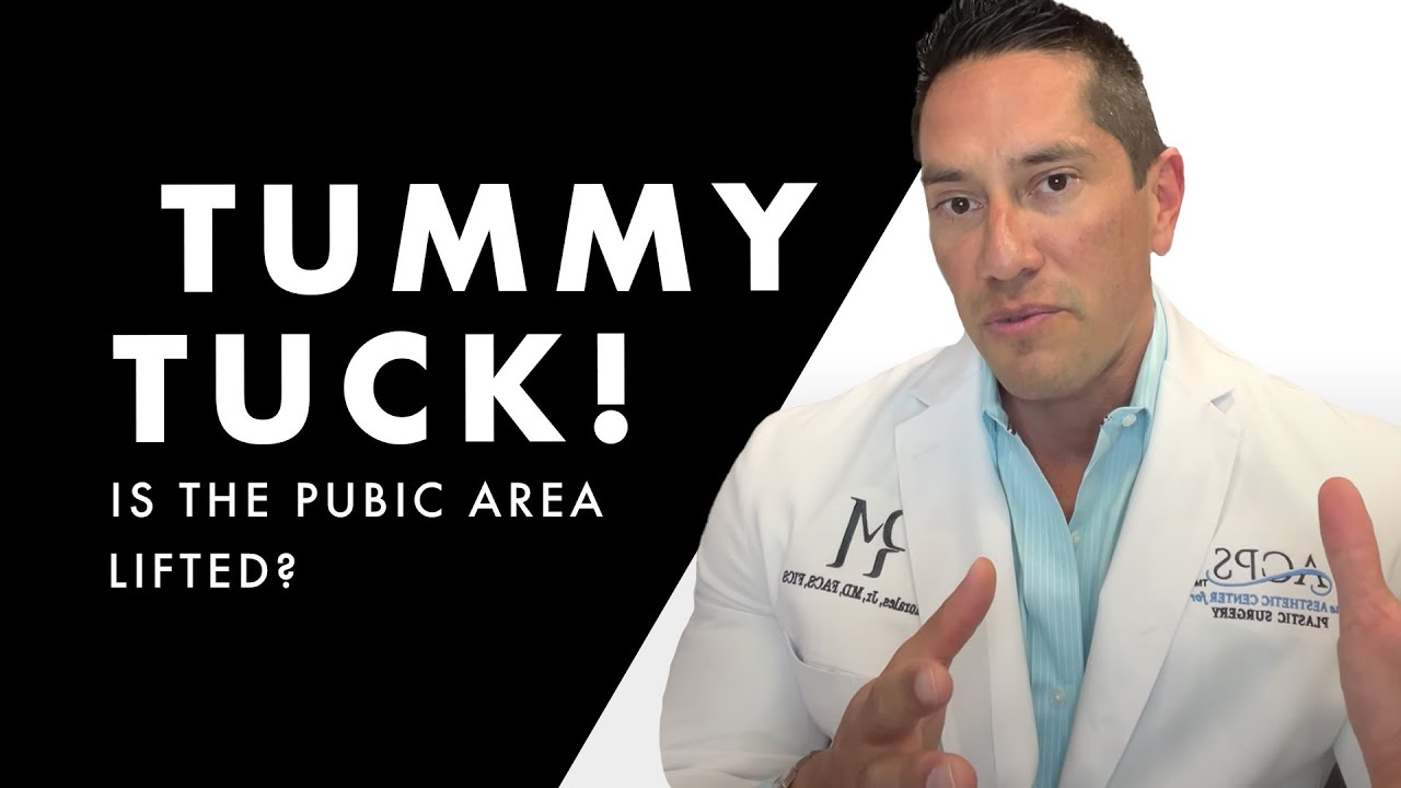 Is The Pubic Area Lifted in a Tummy tuck?