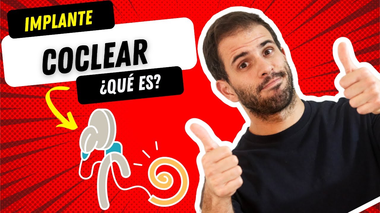 ¿Qué es un implante coclear y cómo funciona?