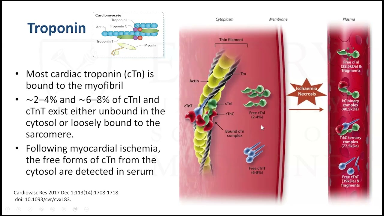 Biomarkers for Precision Care of Cardiovascular Diseases