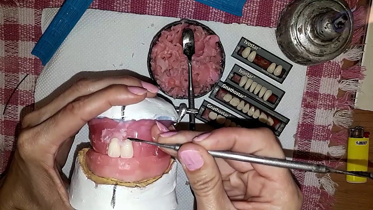 ENFILADO DENTAL 1 x 6 Superior