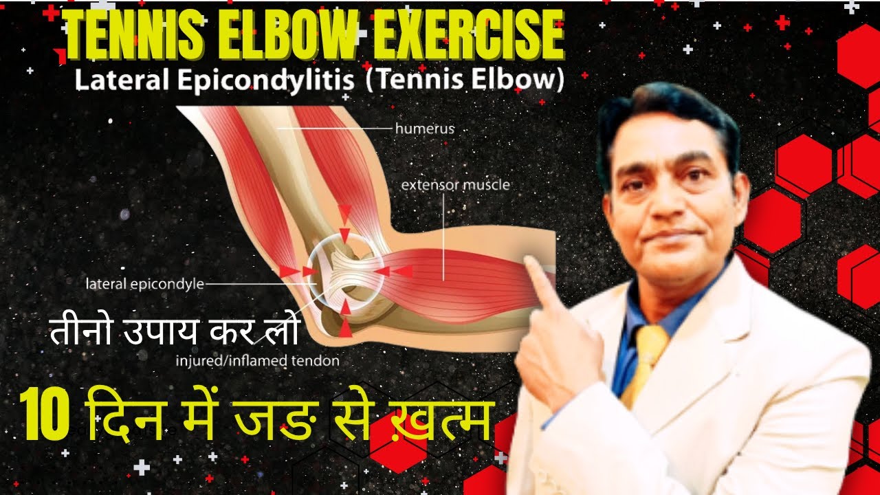 ये तीनो उपाय कर लो टेनिस एल्बो दर्द जड़ से ख़तम हो जायेगा !tennis elbow exercises #tenniselbowexercise