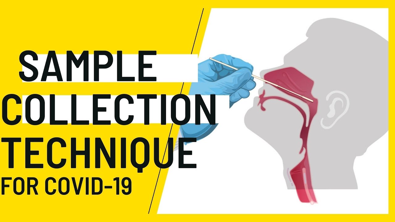 Nasopharyngeal Sample Collection procedure for Covid-19