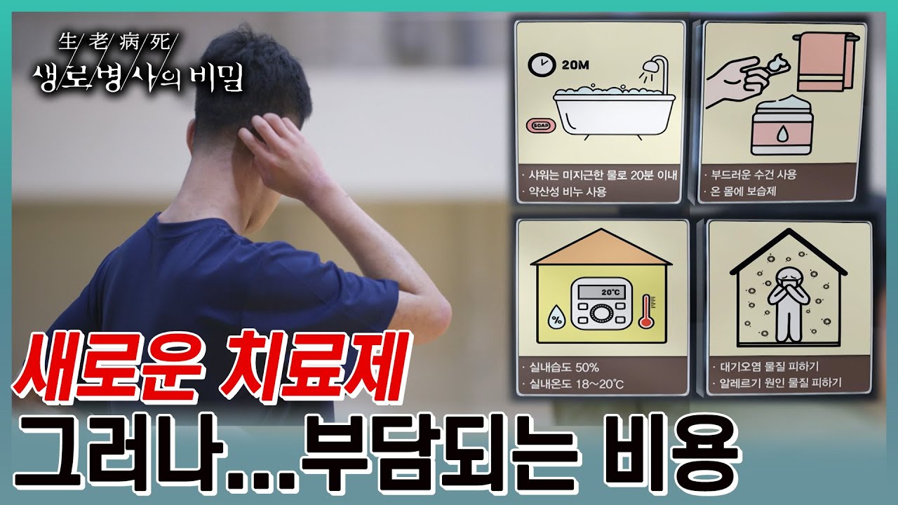 새로운 치료제의 등장으로 아토피 피부염 환자들이 치료 선택지가 많아졌지만, 높은 비용 때문에 걱정이 앞서는데... (KBS 20230628 방송)
