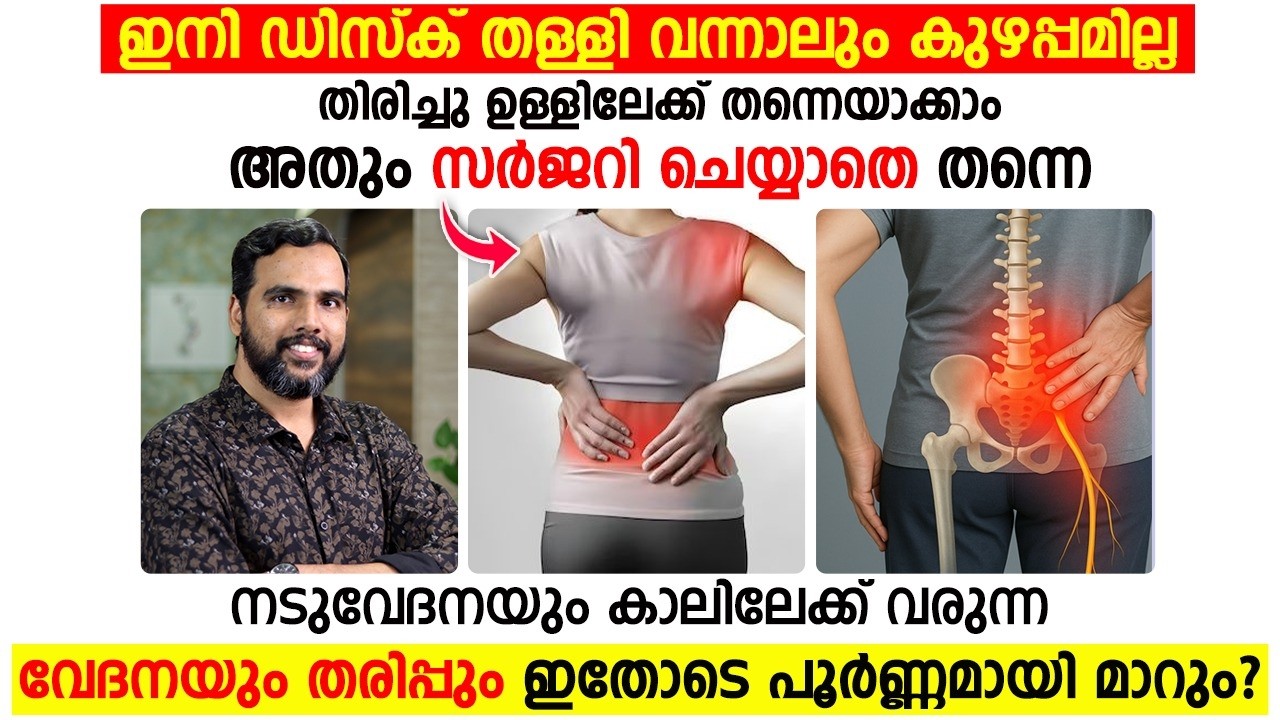 ഡിസ്ക് തള്ളി വന്നാലും ഭയക്കേണ്ട! സർജറി ഇല്ലാതെ തന്നെ പൂർണ്ണമായും മാറുമോ?.Dr. Nishad PK