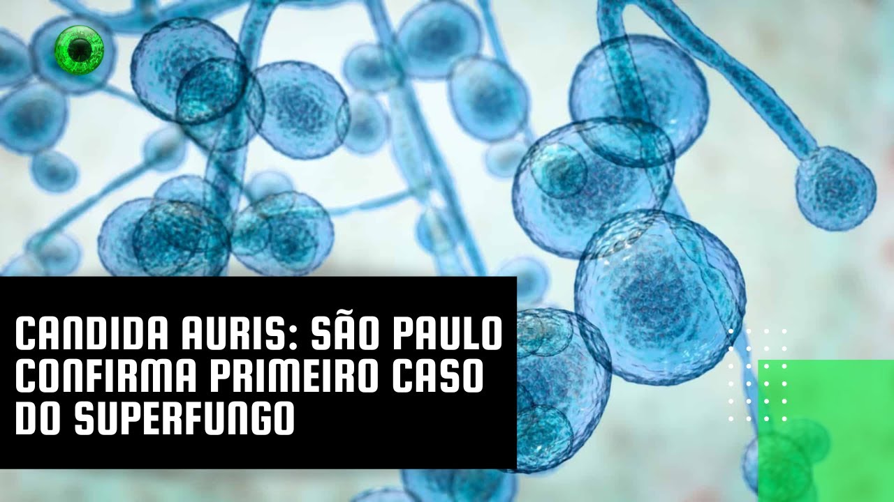 Candida auris: S&atilde;o Paulo confirma primeiro caso do superfungo