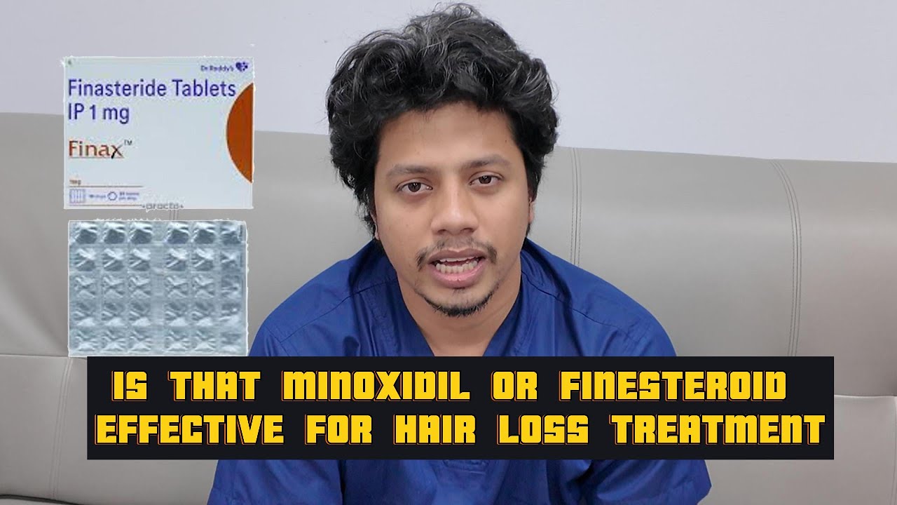 minoxidil and finesteride side effect. hair transplant. hair fall solution. hair style.