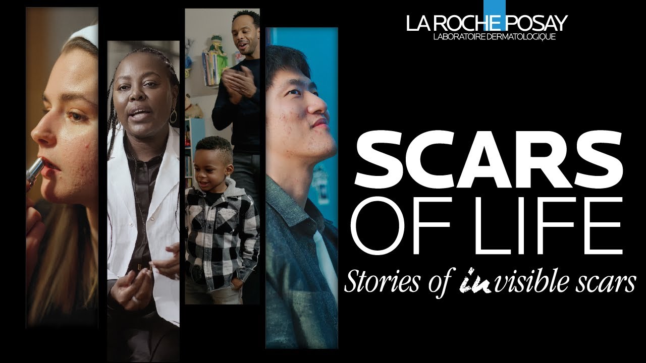 SCARS OF LIFE | Full Documentary | La Roche-Posay