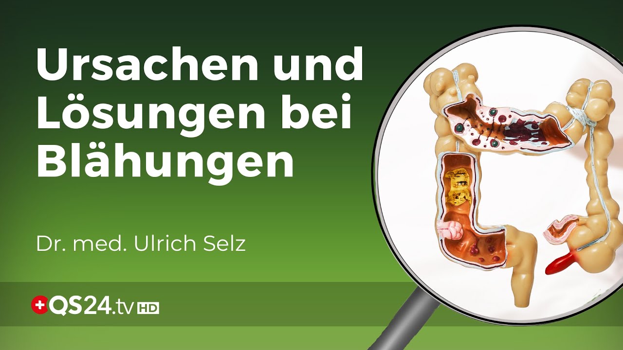 Die Hauptursachen für Blähungen | Dr. med. Ulrich Selz | Erfahrungsmedizin | QS24