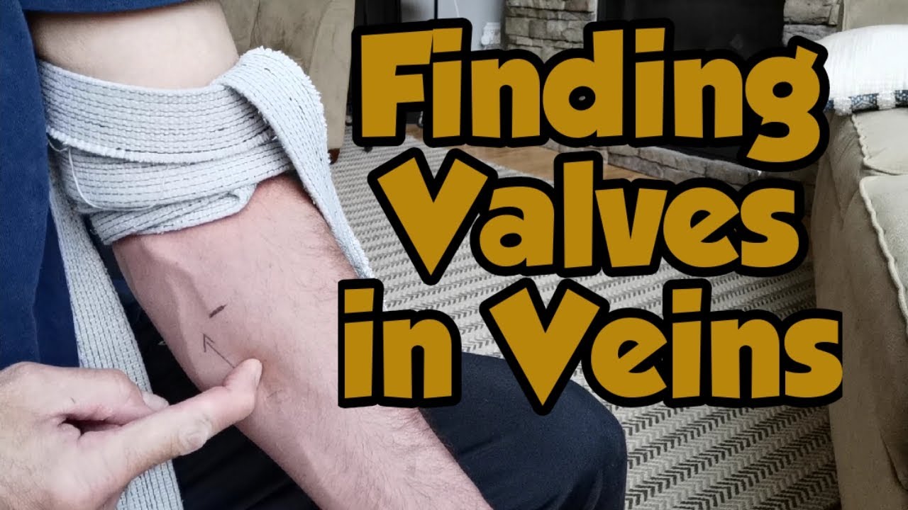 Finding Valves in Veins