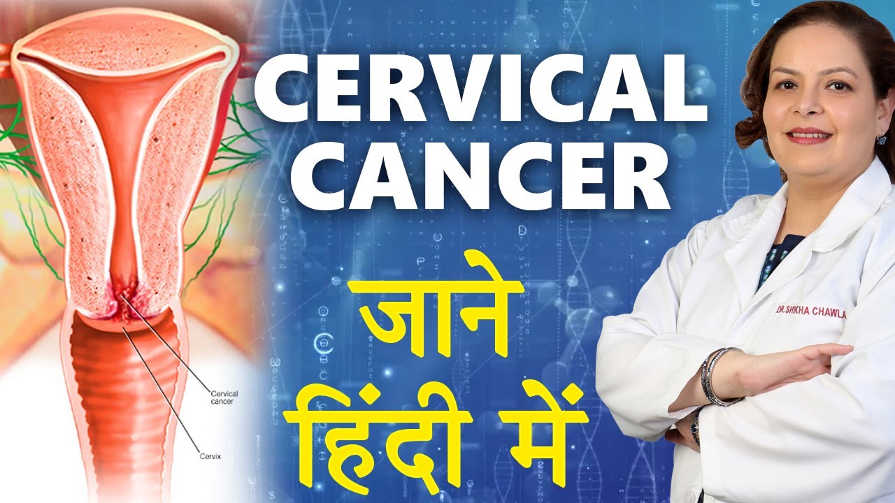 Cervical Cancer In Hindi | गर्भाशय कैंसर जाने हिंदी में  | Dr Shikha Chawla