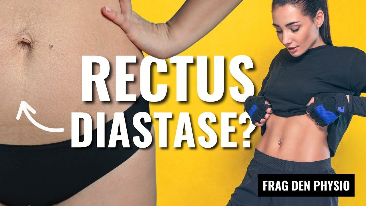 Rektusdiastase & Training: Sicherer Aufbau von Bauchmuskeln nach Geburt?