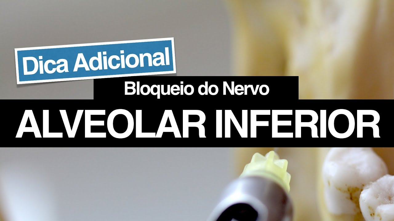 Bloqueio do Nervo Alveolar Inferior - Dicas Adicionais Para Aumentar o seu Sucesso