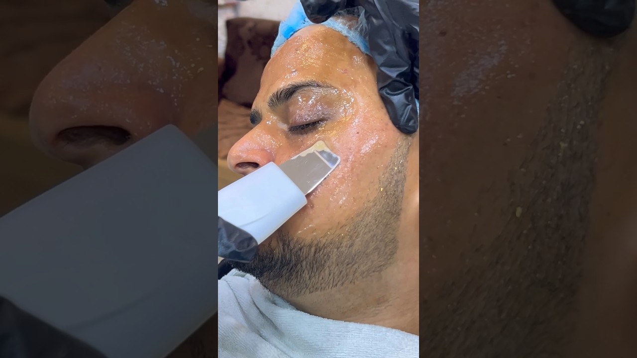 Wedding facial skin treatment! & hydrated skin hydra facial #wedding #facialtreatment #skin #mr