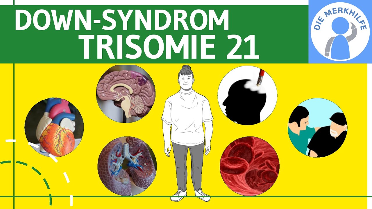 Down Syndrom / Trisomie 21 - Definition, Merkmale, Ursachen & Formen & Unterscheidungen - Genetik