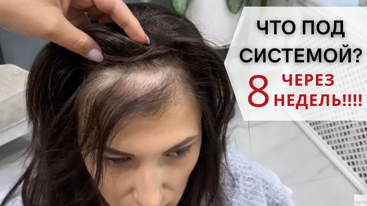 КОЖА И ВОЛОСЫ ЧЕРЕЗ 8 НЕДЕЛЬ  восстановление волос алопеция