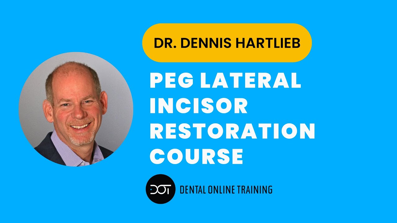 Peg Lateral Incisor Restorations | Dr. Dennis Hartlieb | Dental Online Training