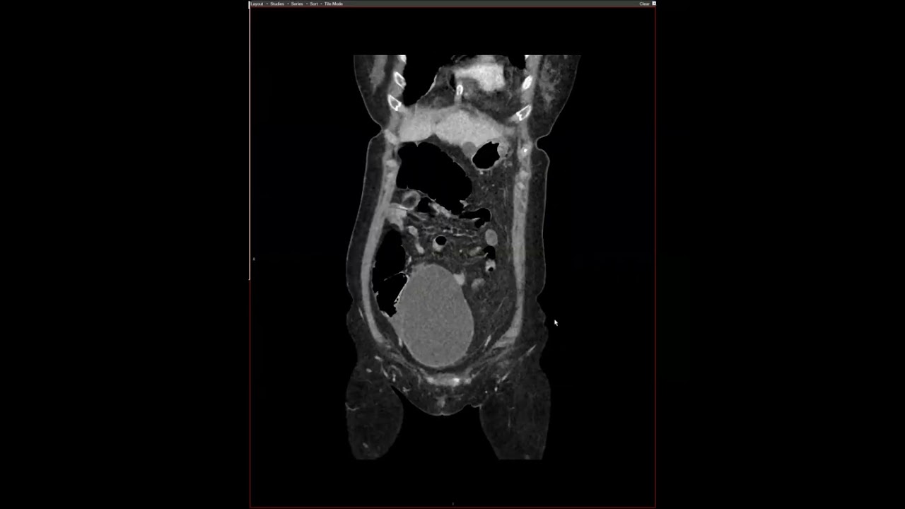 Abdominal Case Conference 2026 - Session 2