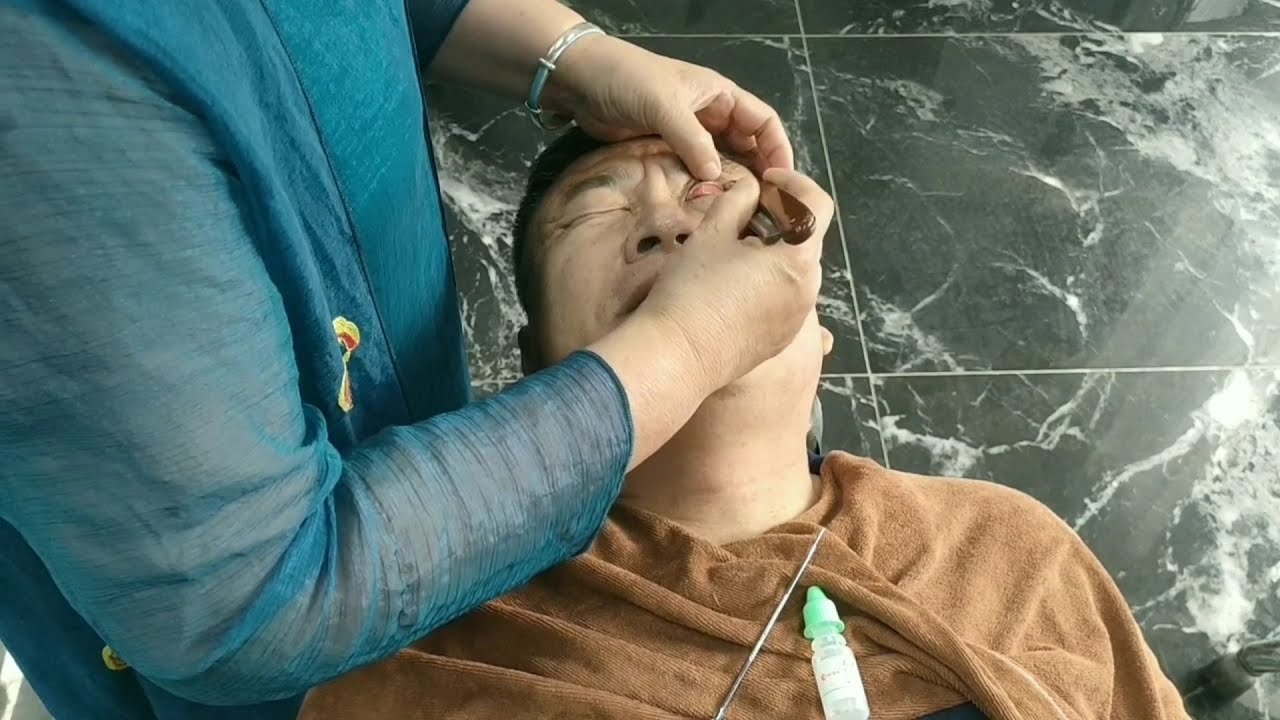 Eye cleaning chinese/Eye spa/目の掃除/눈 청소【Eye ASMR】