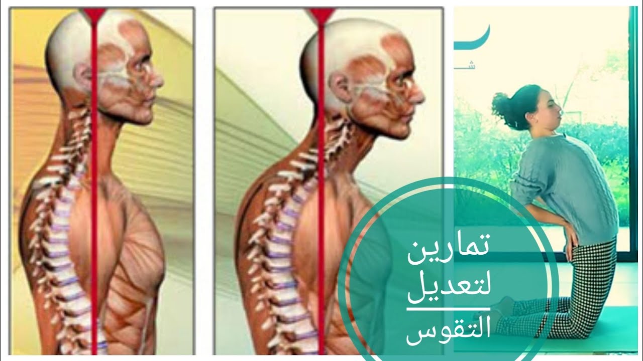 حل لتقوس الظهر في 3 اسابيع - شدانا يوغا
