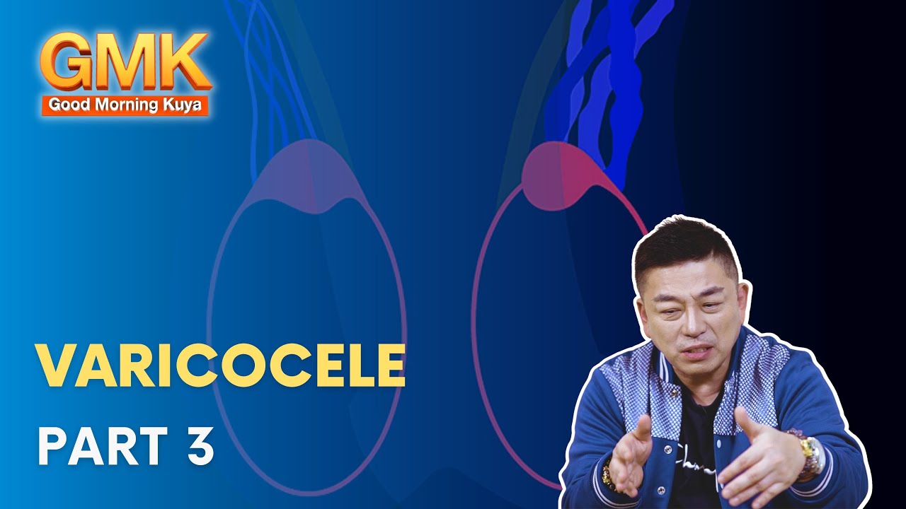 Kung naipagamot na ang Varicocele, posible bang magkaroon ulit? | Usapang Pangkalusugan