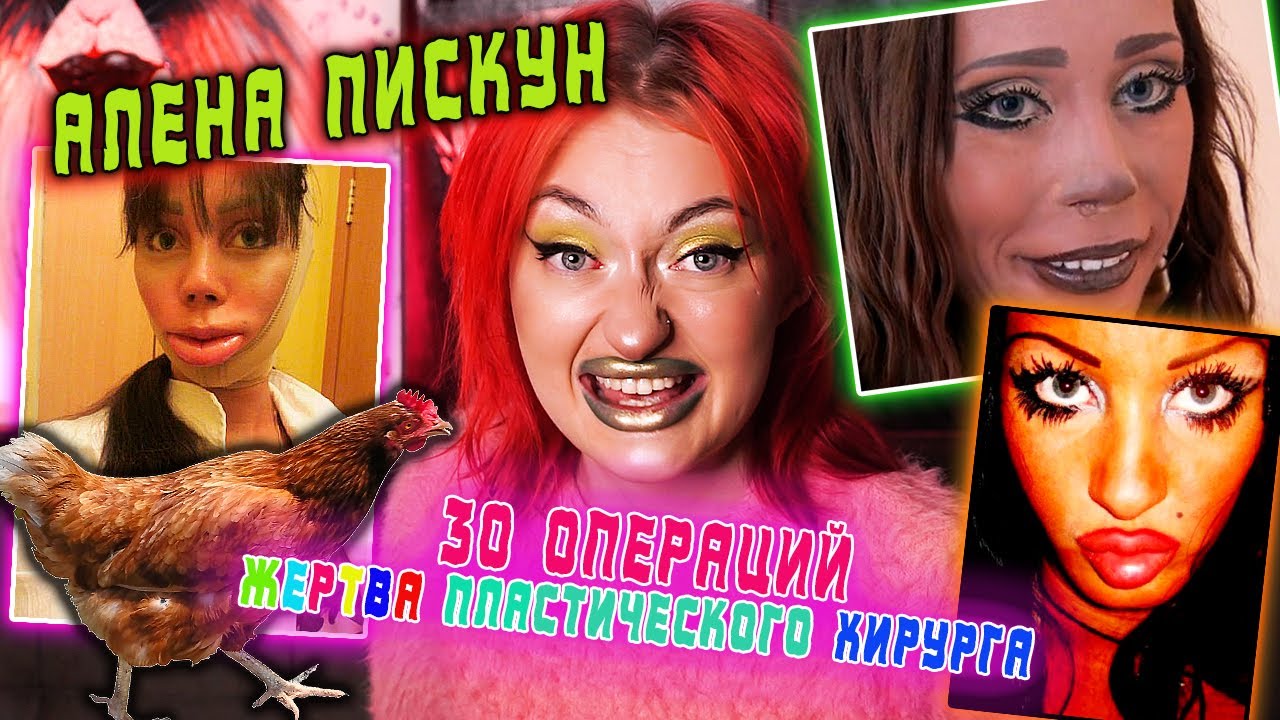 СТРАШНАЯ ИСТОРИЯ АЛЕНЫ ПИСКУН/ ЖЕРТВА ПЛАСТИЧЕСКОГО ХИРУРГА