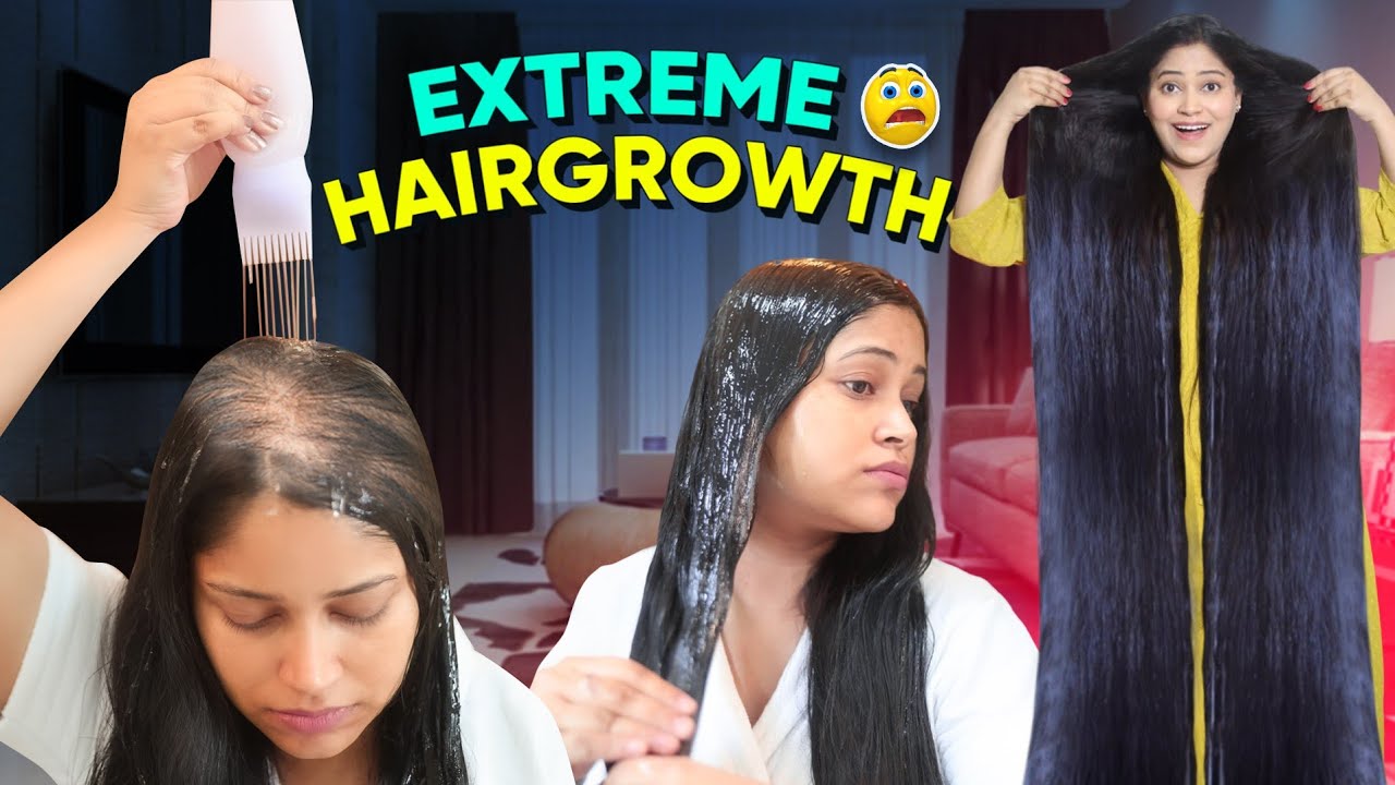 😱I Applied only Few Drops of this Diy & Got Triple Hairgrowth गंजेपन से तुरंत बचना है तो ये लगा लो👌