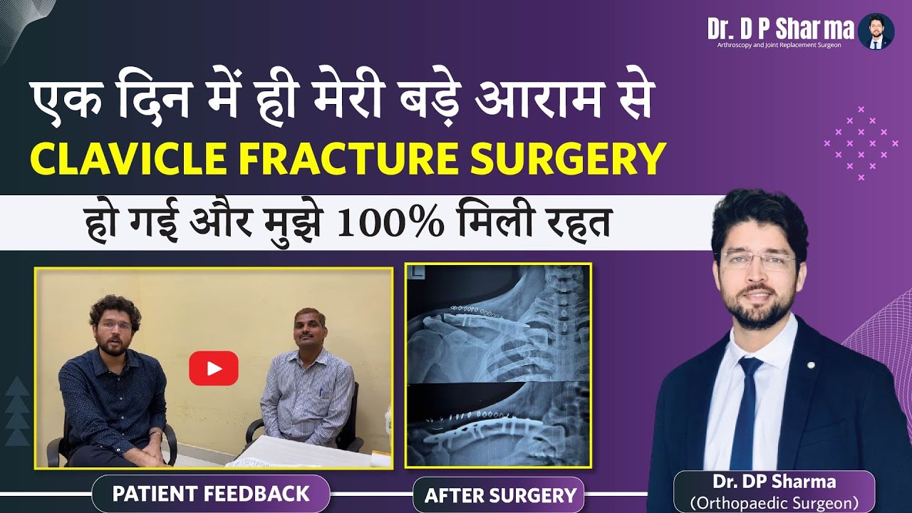 Patient Got 100% Satisfaction After Clavicle Fracture Surgery in Agra & Delhi NCR Dr DP Sharma