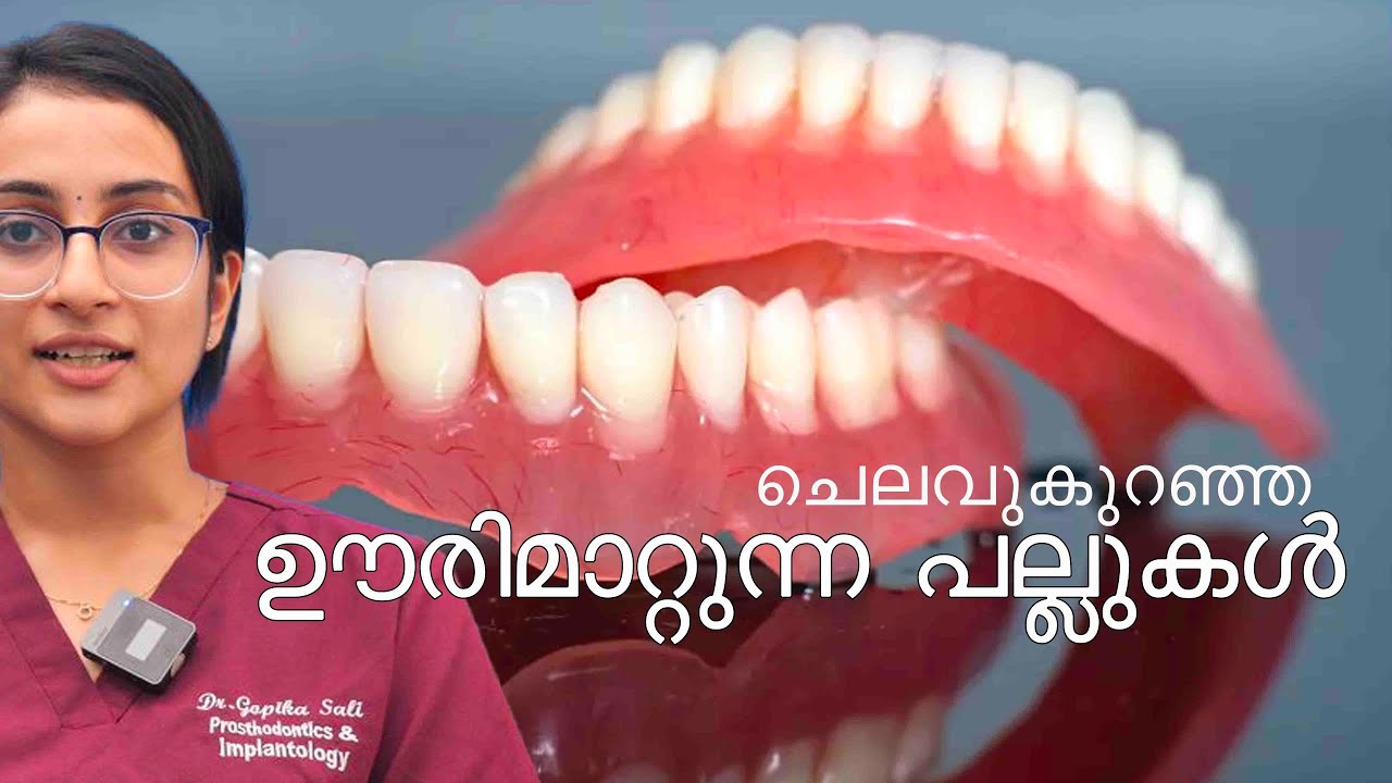 ഊരിമാറ്റുന്ന പല്ലുകൾ (Veppu Pallu) അറിയേണ്ടതെല്ലാം!
