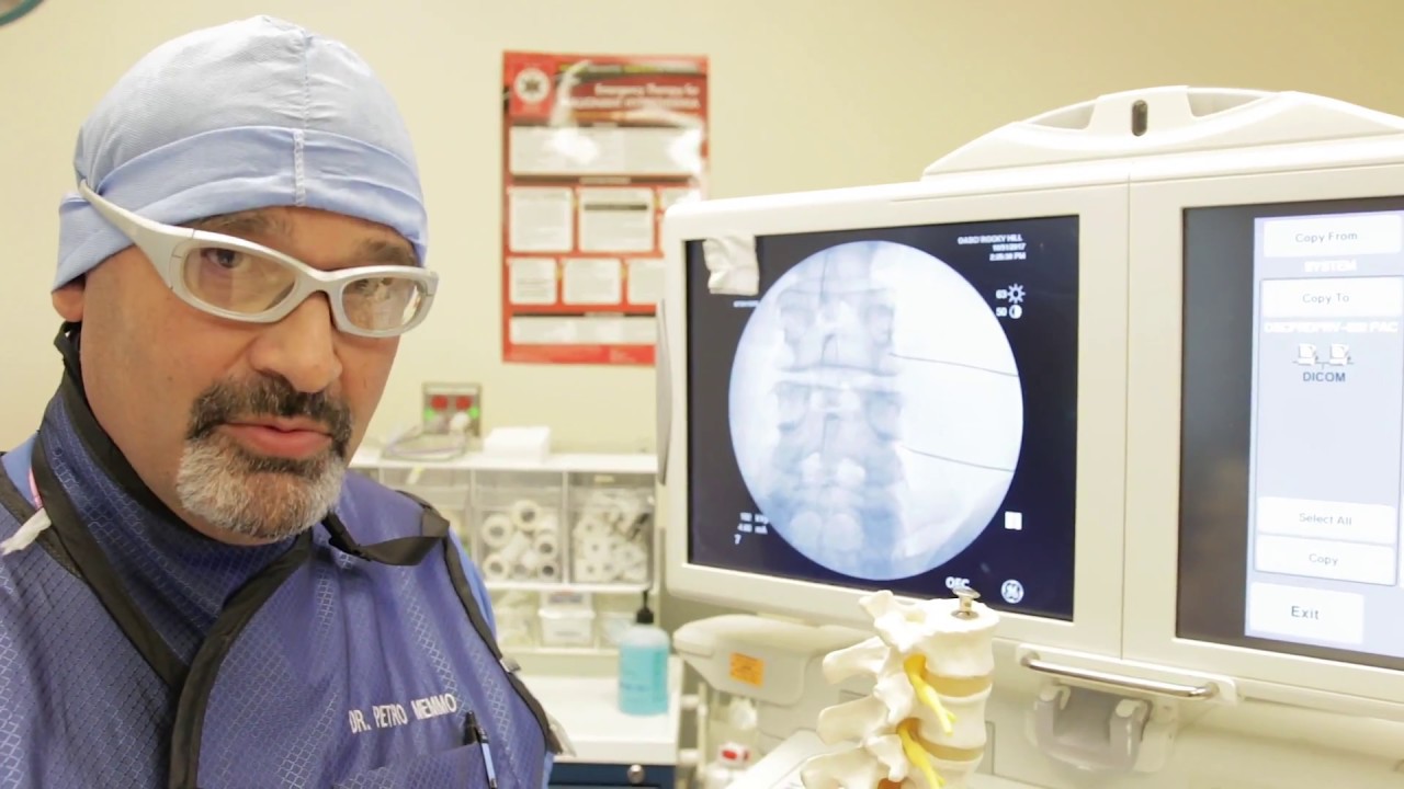 Dr. Pietro Memmo - Transforaminal Epidural Injection