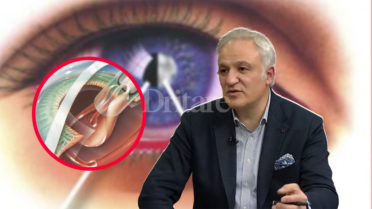 Si bëhet operimi i perdes së syrit! Ja çfarë duhet të dini! | Shqip nga Rudina Xhunga