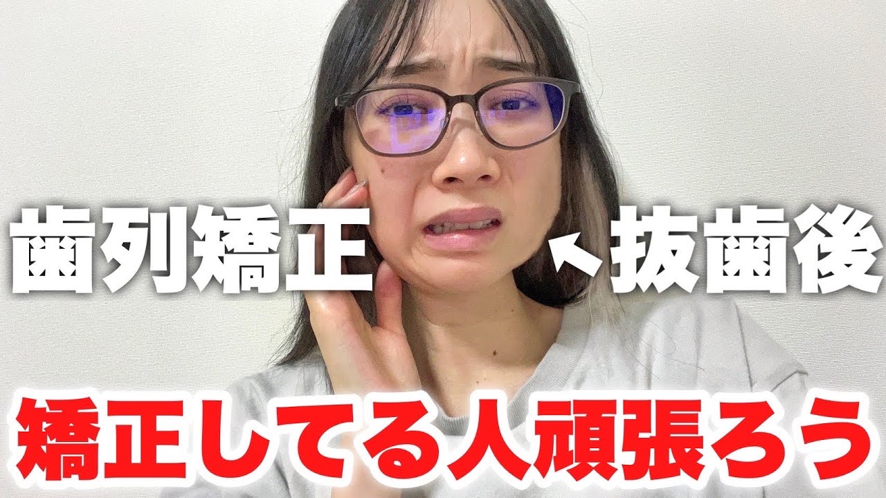 矯正中に親知らず抜いて何も食べれないのに友達とホワイトデー迎えるのつらwww