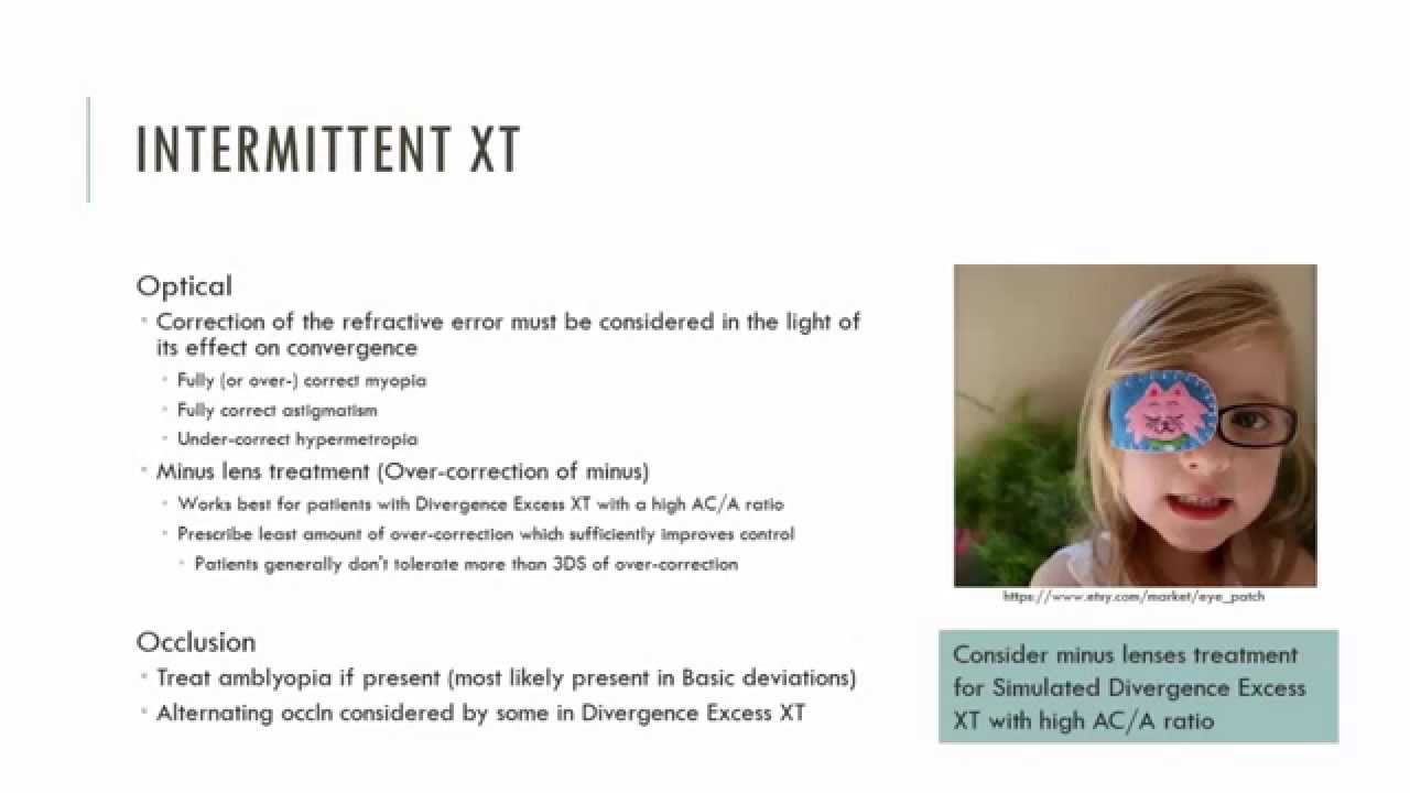 Intermittent Exotropia Management