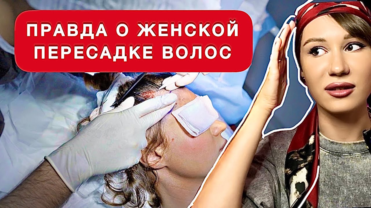 ВСЯ ПРАВДА О ЖЕНСКОЙ ПЕРЕСАДКЕ ВОЛОС | Трансплантация волос в Турции (Стамбуле)